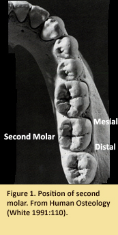 Image of right bottom of a mouth showing a section of teeth, including the molars.