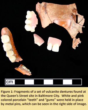 Figure 1: Fragments of a set of vulcanite dentures found at the Queen’s Street site in Baltimore City. White and pink colored porcelain “teeth” and “gums” were held in place by metal pins, which can be seen in the right side of the photograph.