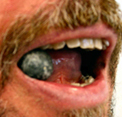 Image of a mouth biting a bullet.