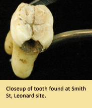 Close-up of tooth with cavity found at Smith St. Leonard site.