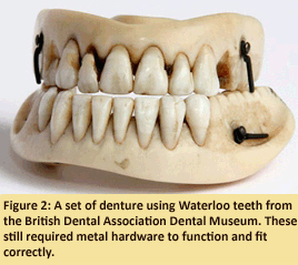 Figure 2: A set of dentures using Waterloo teeth from the British Dental Association Dental Museum. These still required metal hardware to function and fit correctly.